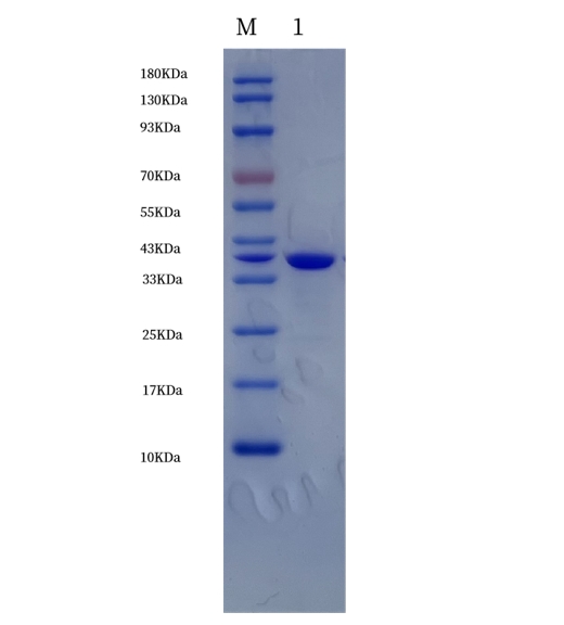 M: Marker
Lane 1: Recombinant Inorganic Pyrophosphatase